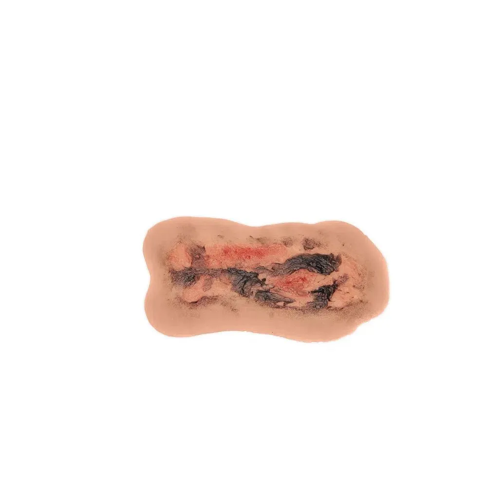 Adhesive Simulated Burns - 4 stages kit