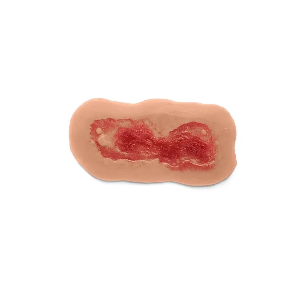 Adhesive Simulated Burns - 4 stages kit