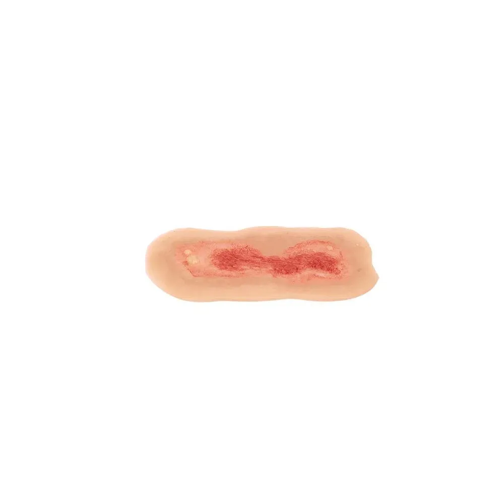 Adhesive Simulated Burns - 4 stages kit