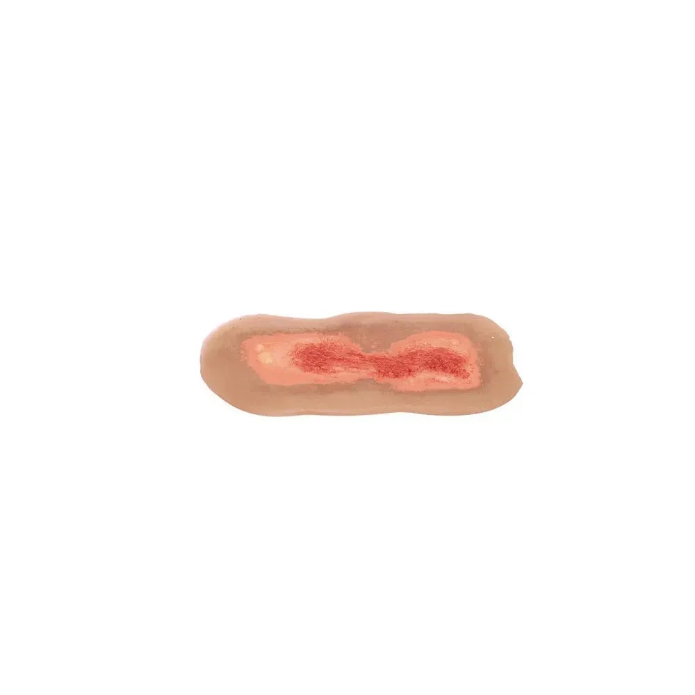 Adhesive Simulated Burns - 4 stages kit