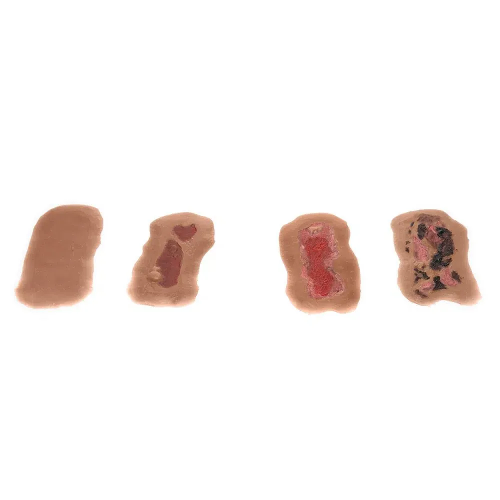 Adhesive Simulated Burns - 4 stages kit