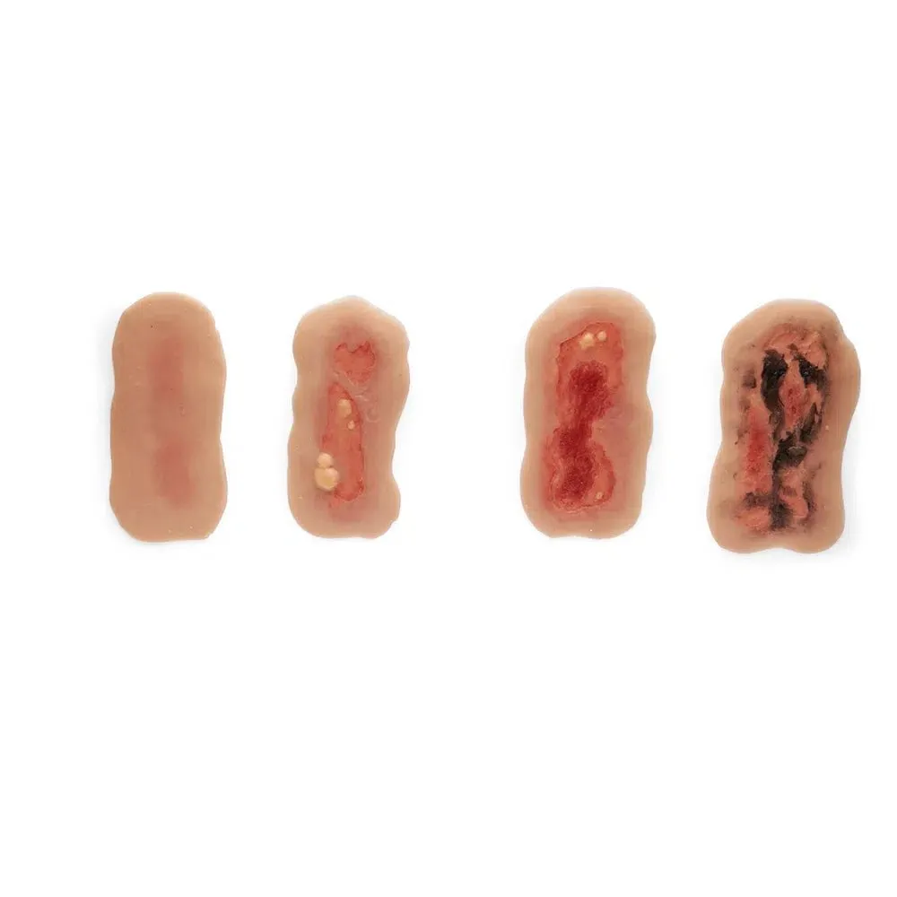 Adhesive Simulated Burns - 4 stages kit