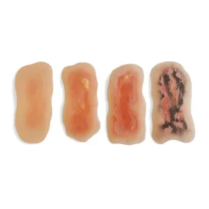 Adhesive Simulated Burns - 4 stages kit
