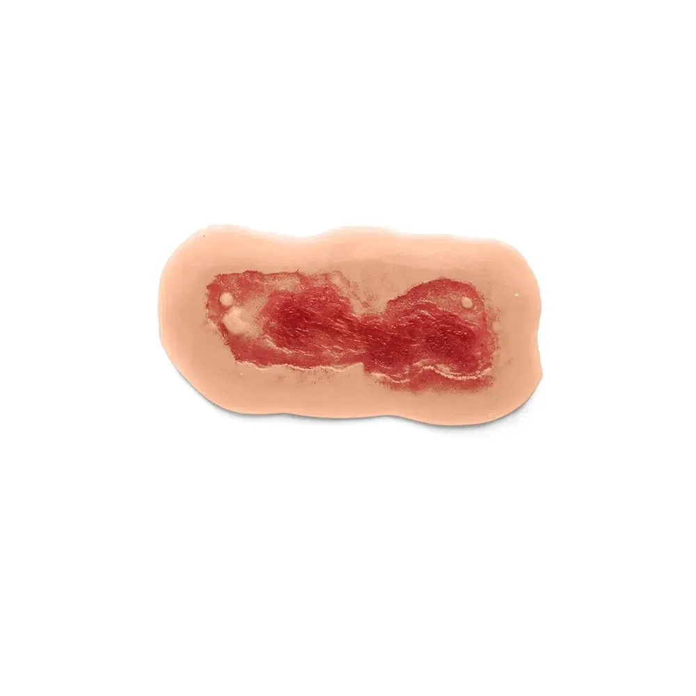 Adhesive Simulated Burns - 4 stages kit