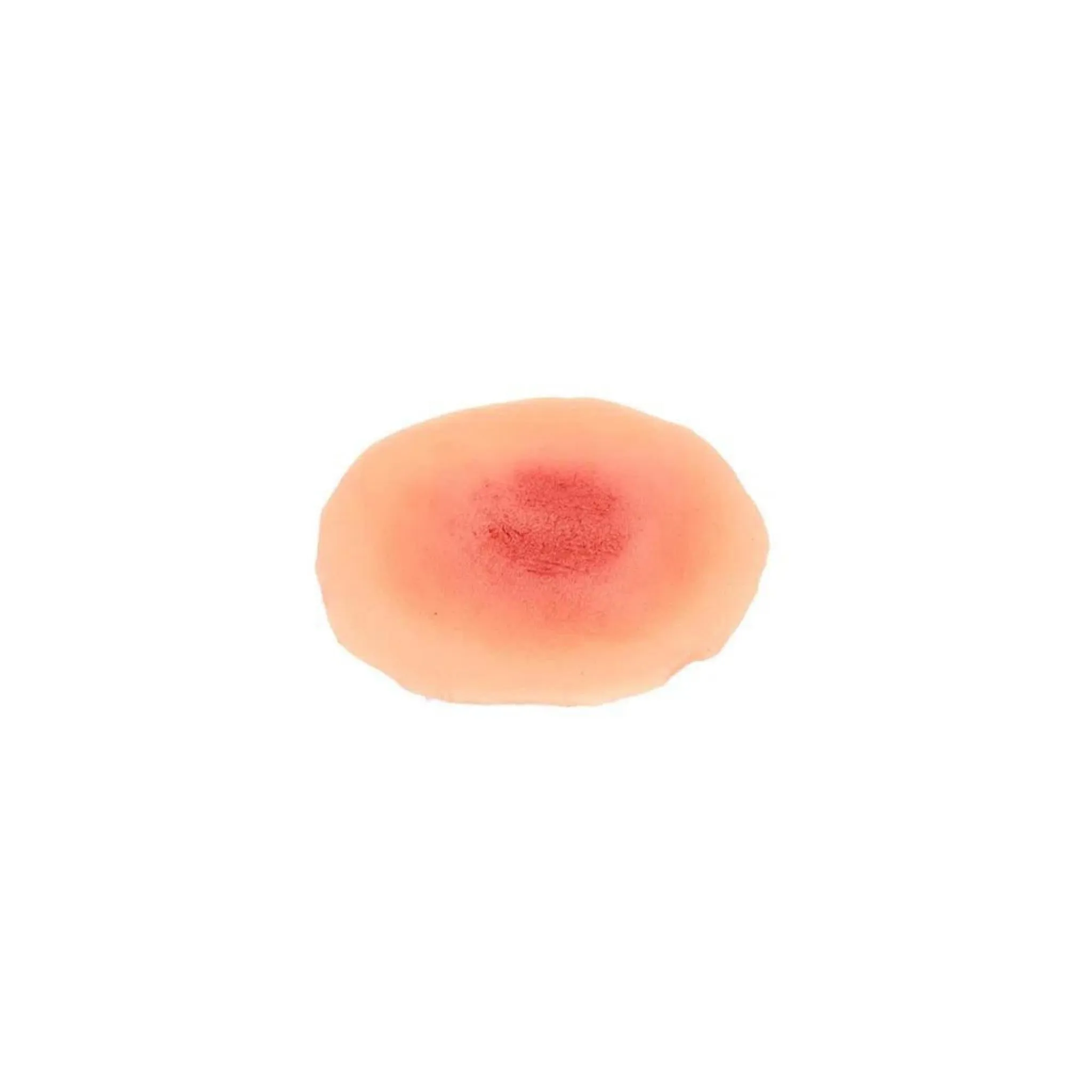 Fine Skin Rash Sticky Wounds