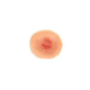 Fine Skin Rash Sticky Wounds