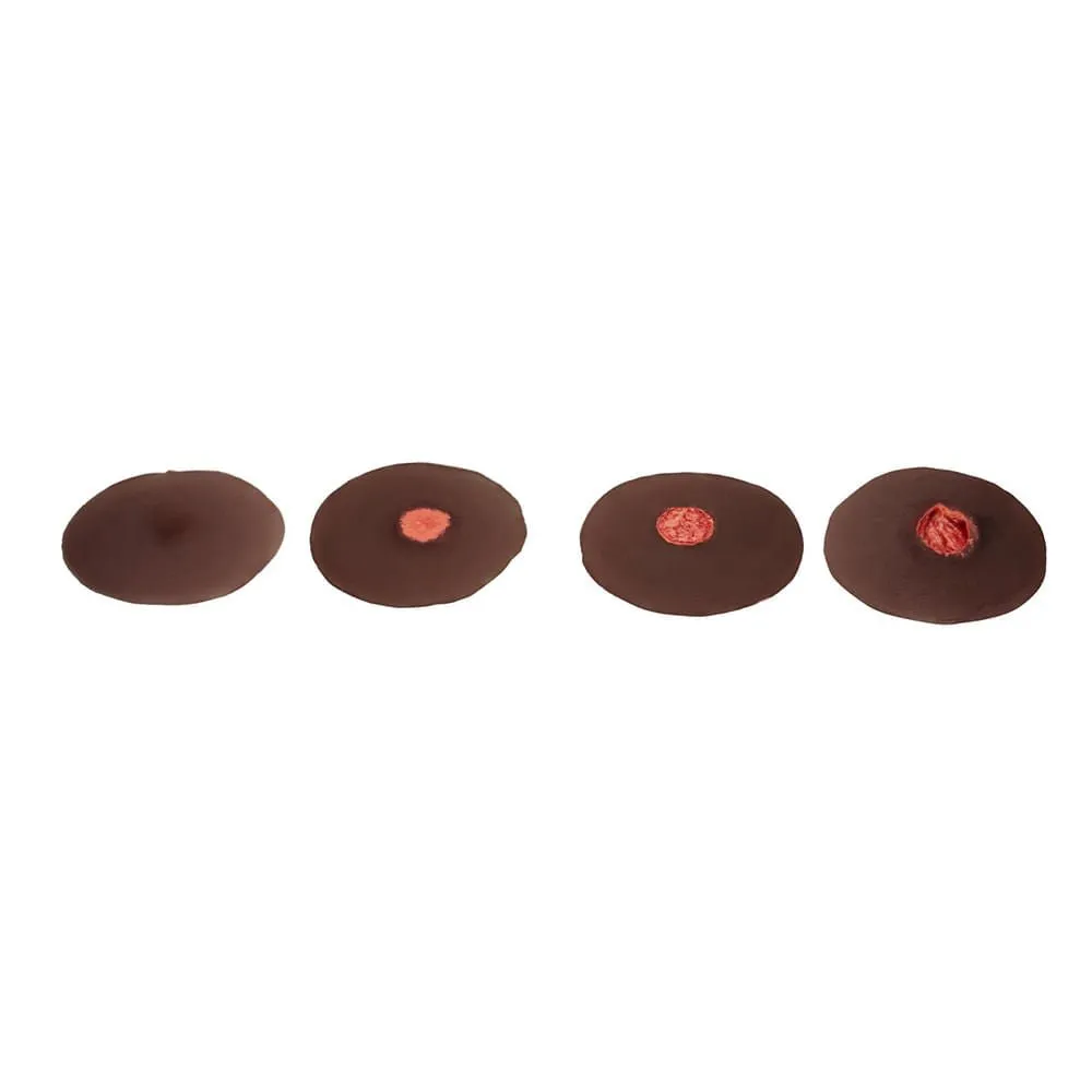 Pressure Ulcer Sticky Wound Kit