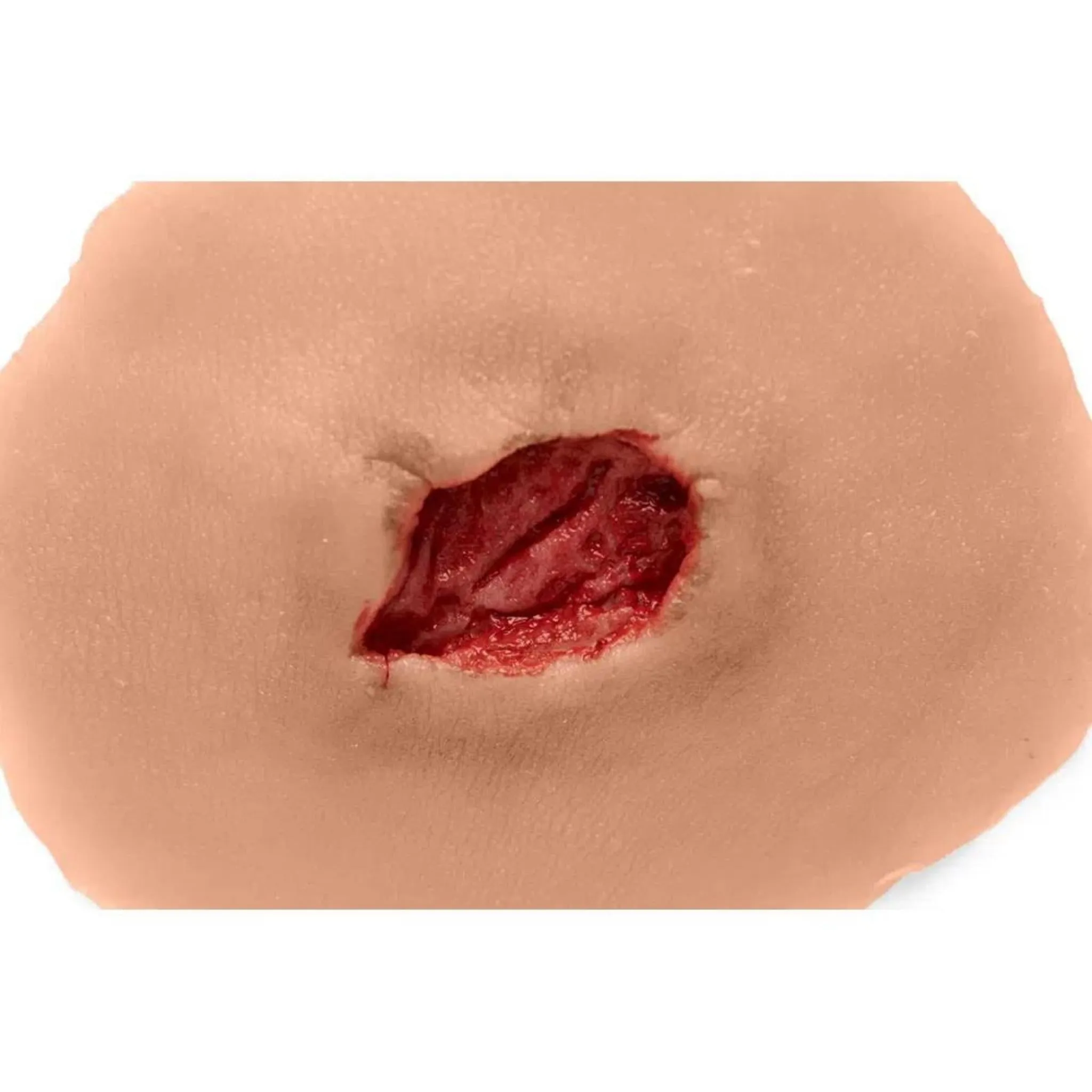 Small Open Sticky Wound
