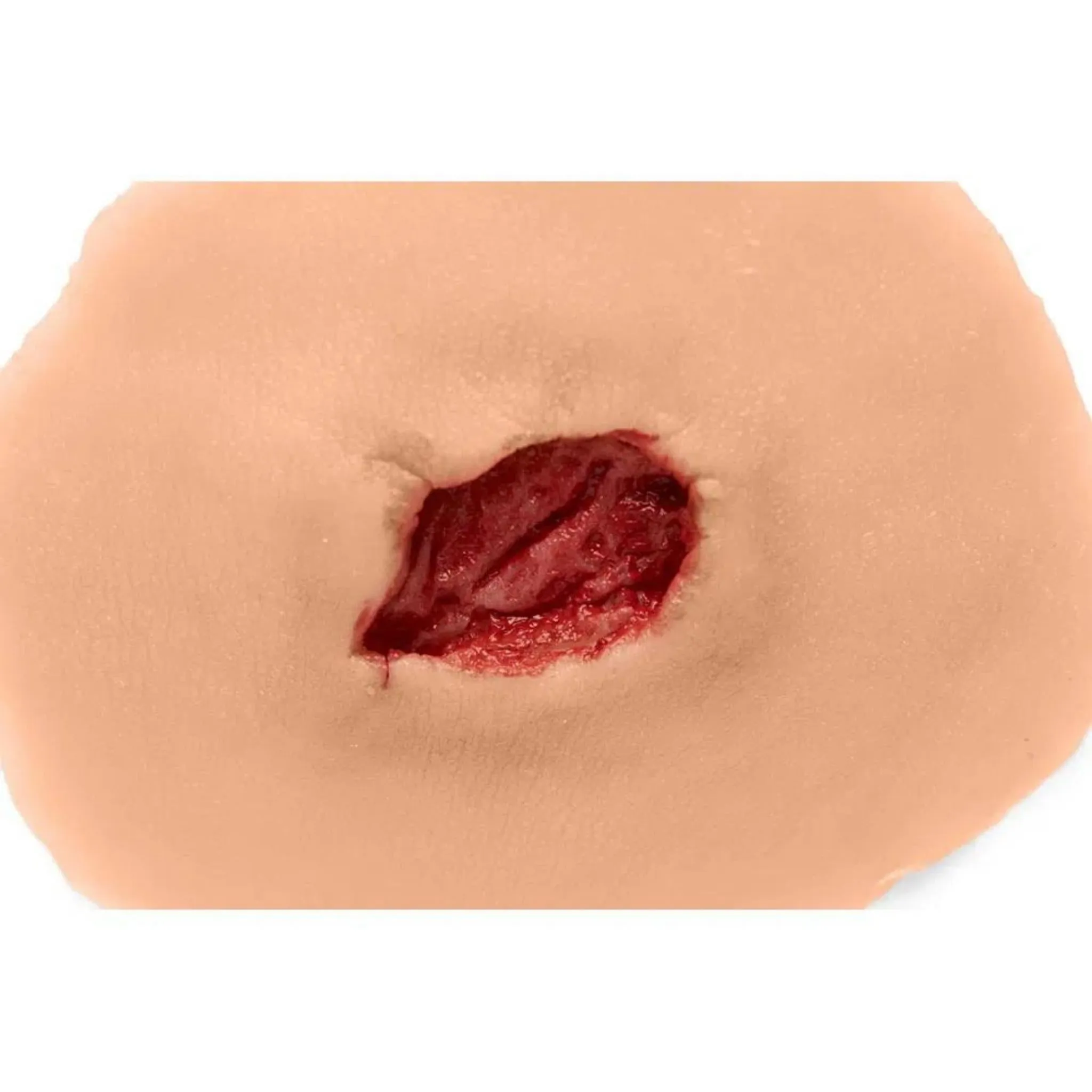 Small Open Sticky Wound