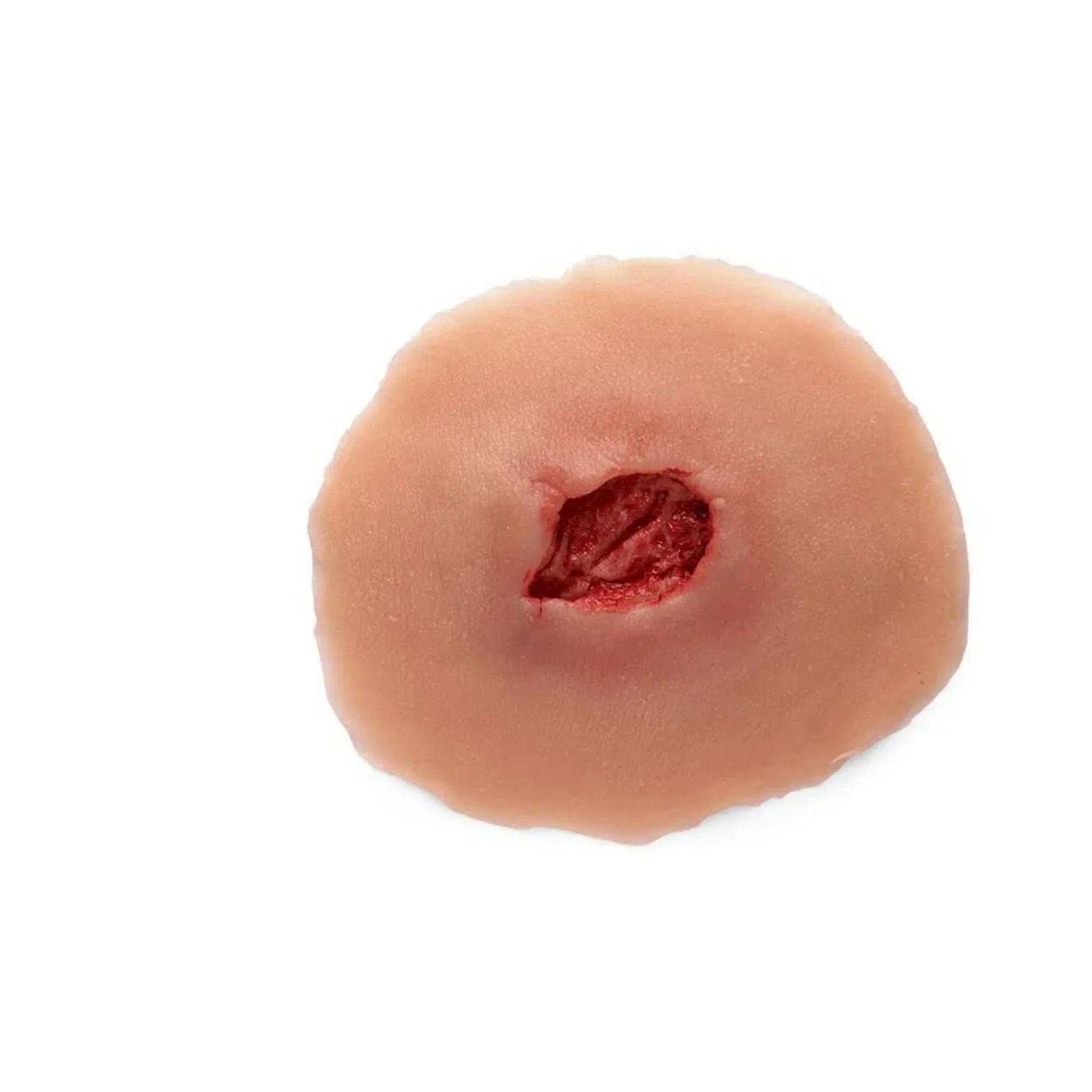 Small Open Sticky Wound