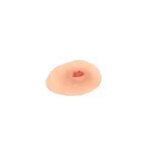 Small Open Sticky Wound