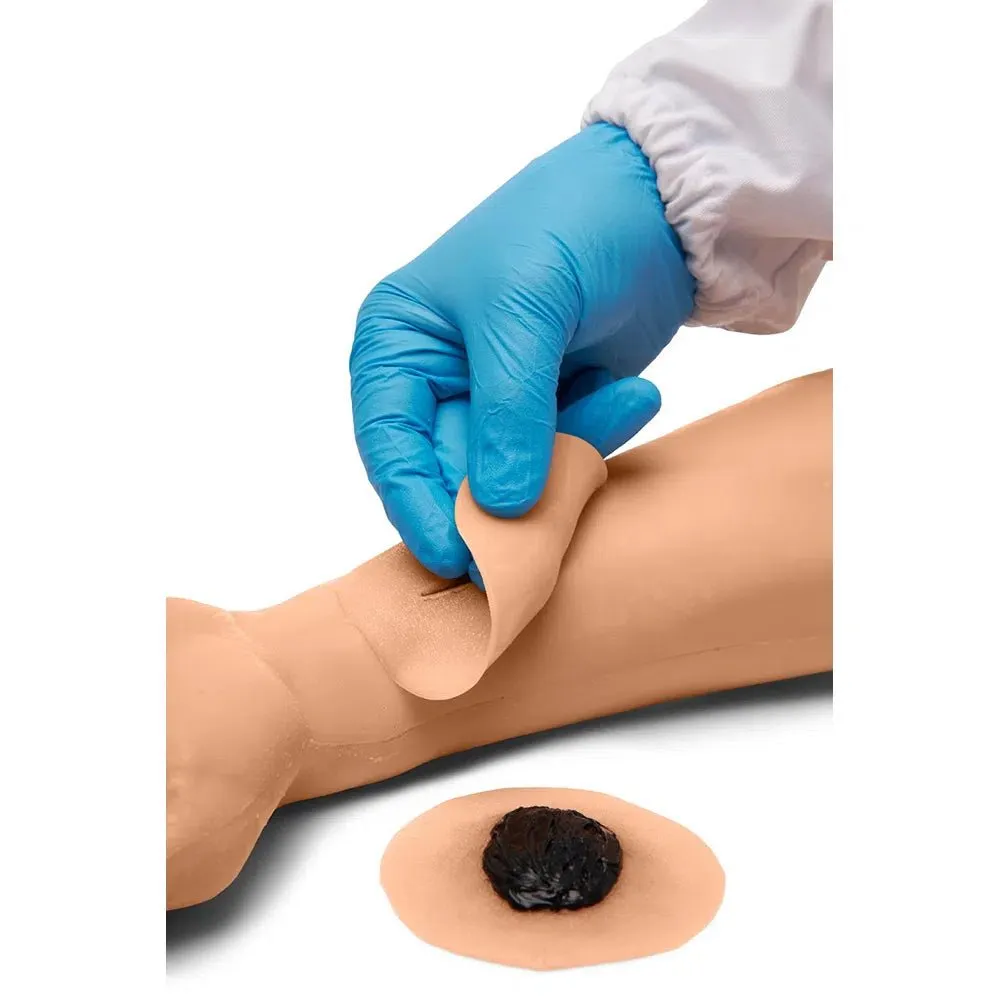 Sticky Wound Kit