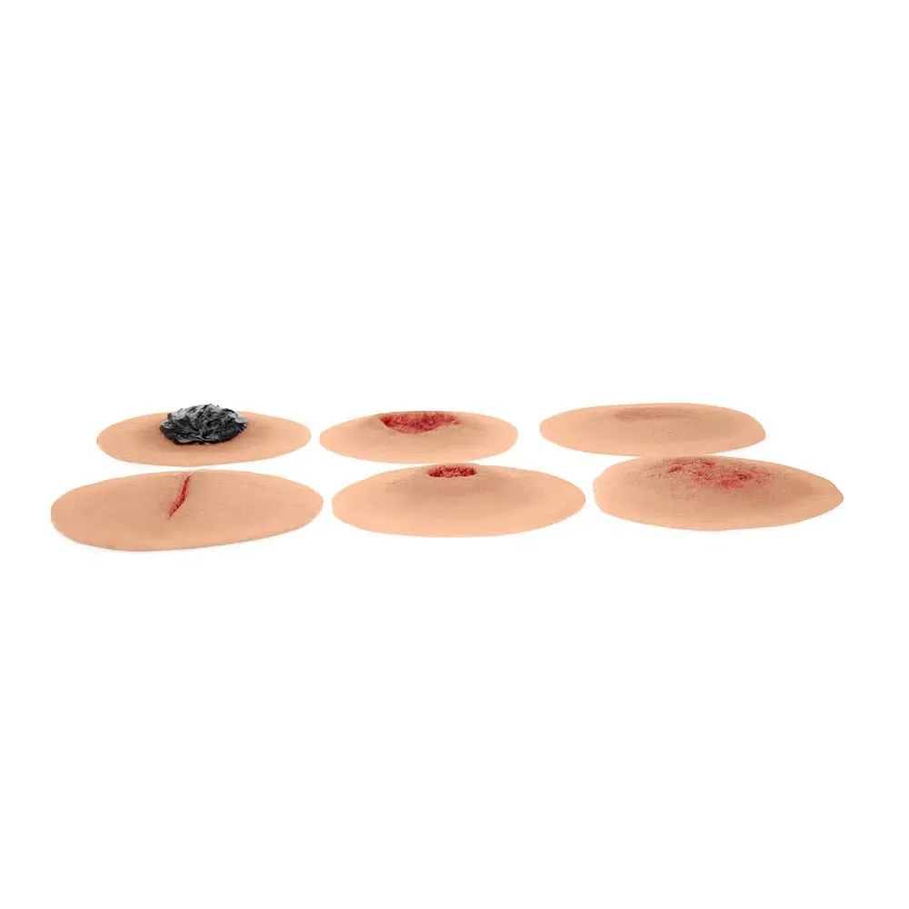 Sticky Wound Kit