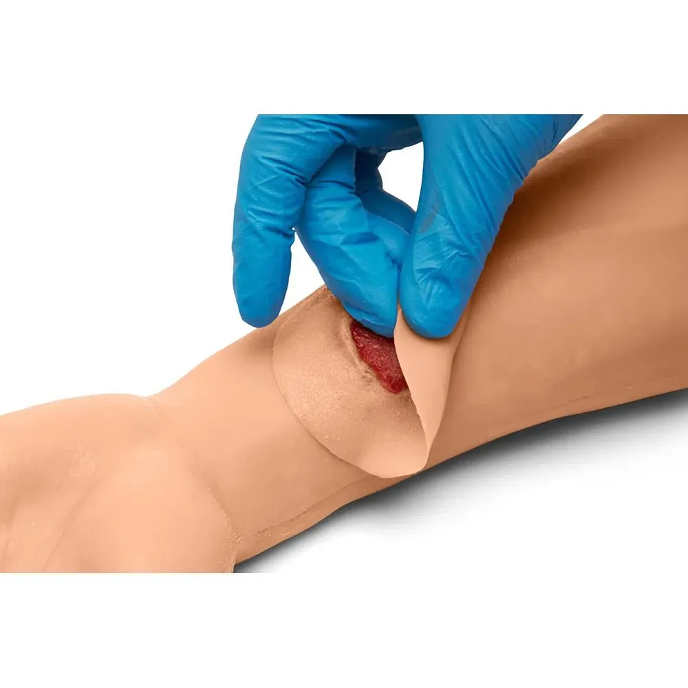 Sticky Wound Kit