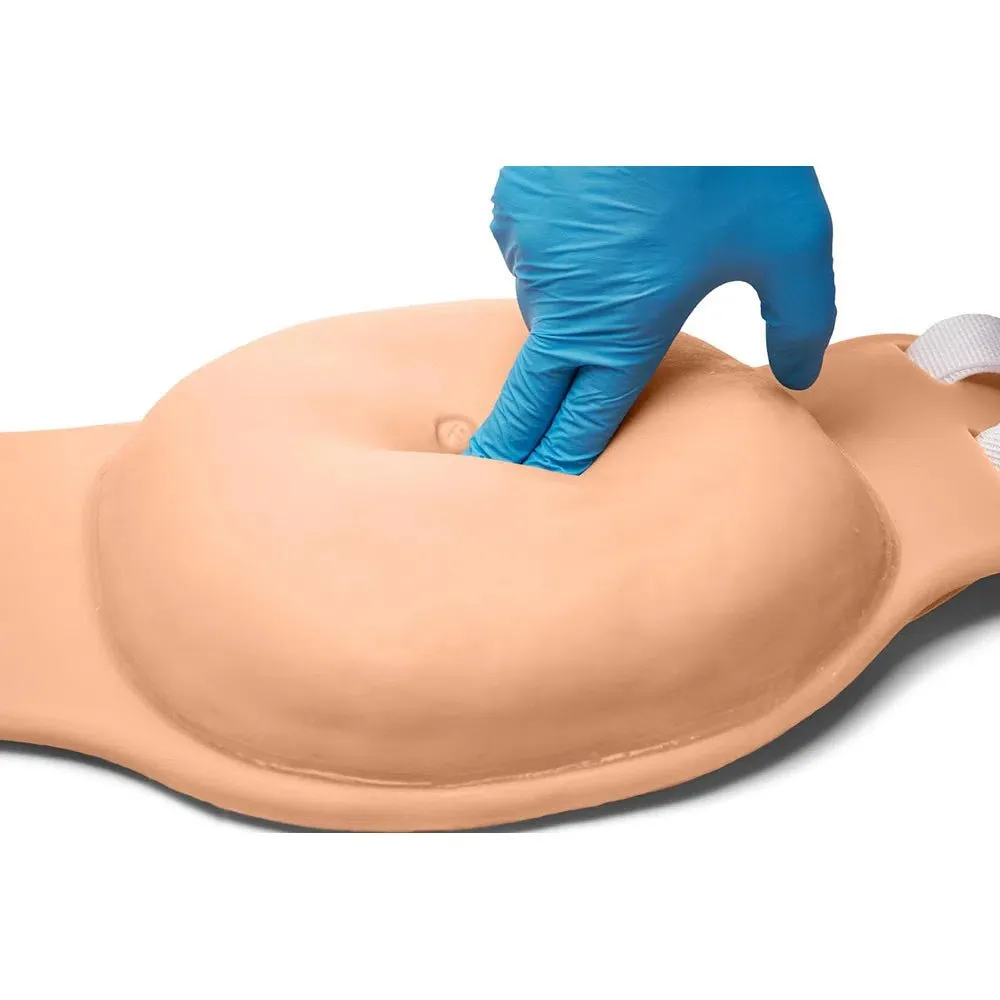 Uterine Fundus Abdomen