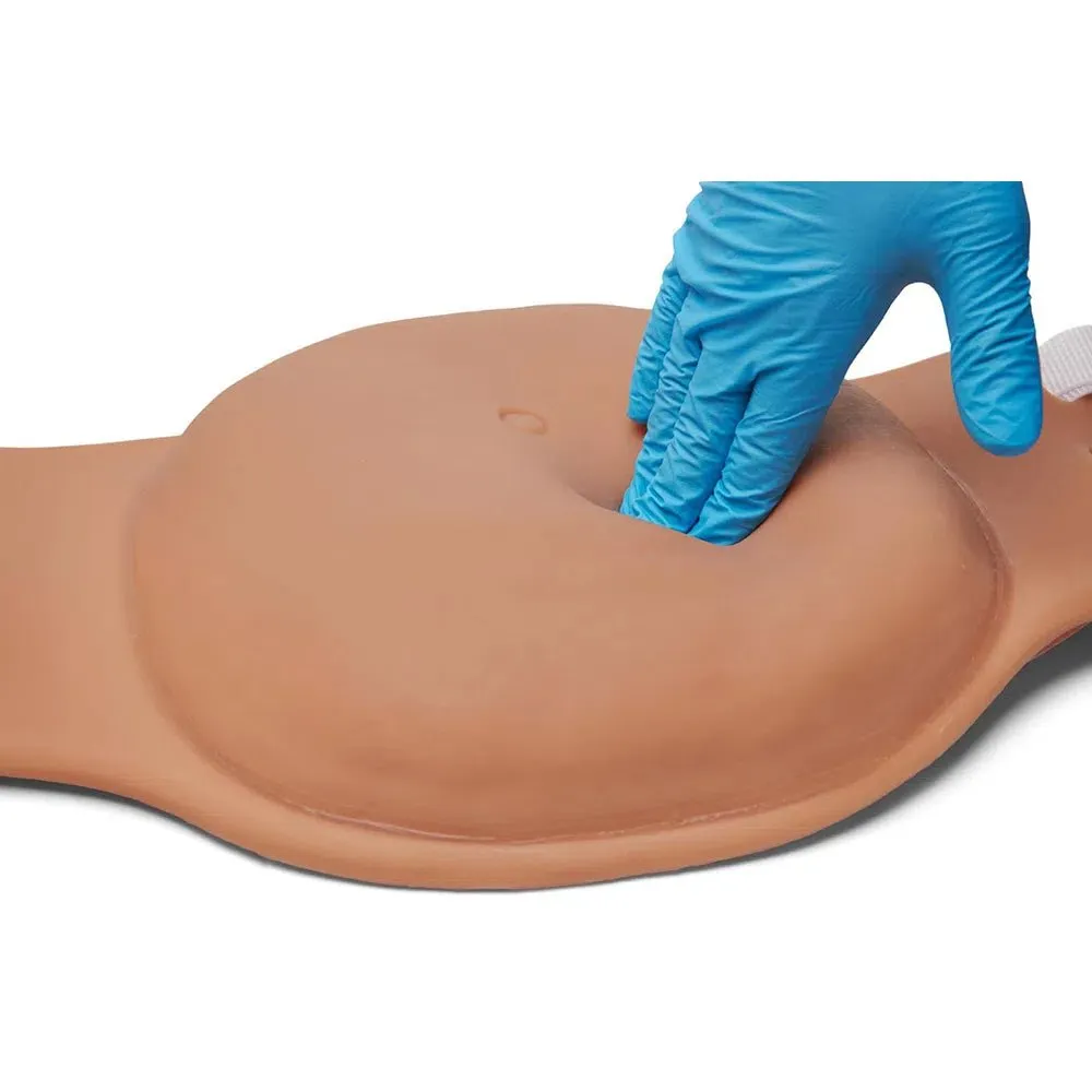 Uterine Fundus Abdomen